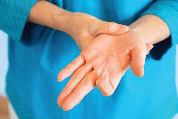 عارضه «انگشت ماشه‌ای» نشانه این بیماری خطرناک است