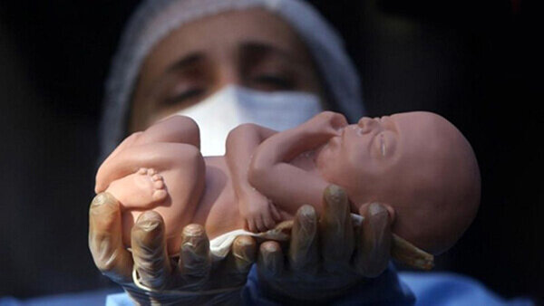 نتایج یک پژوهش درباره دلیل تولد یک میلیون جنین مُرده در سال/ «تراژدی نادیده گرفته شده»