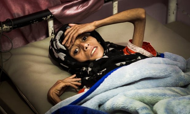 جنگ و قحطی می‌تواند نسل بعدی یمنی‌ها را نابود کند