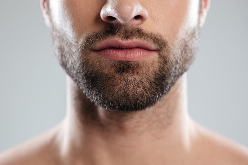 کاشت ریش چقدر موثر است و هزینه آن در سال ۱۴۰۴ چقدر خواهد بود؟