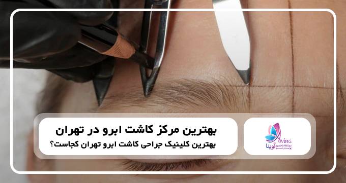 چگونه کلینیک مناسب برای کاشت ابرو را انتخاب کنیم؟ ۵ نکته کلیدی برای یک انتخاب مطمئن